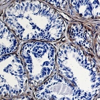 Anti-Caveolin 1 Antibody