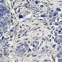 CD91 antibody