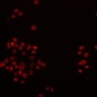 Anti-MLH1 Antibody