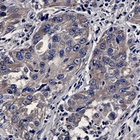Anti-BAX Antibody