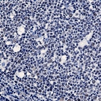 Anti-WTAP Antibody