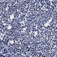 WTAP antibody