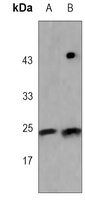 TCF6 Antibody