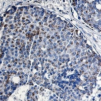 Anti-TCF6 Antibody