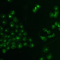 Anti-TCF6 Antibody