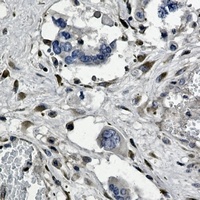 Anti-GNB2 Antibody