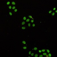 NAT10 antibody