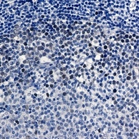 CDK2 Antibody