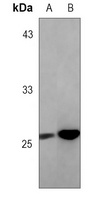 BCL2 Antibody