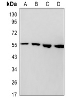 AKT Antibody