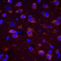 Anti-CHAT Antibody