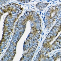 Nesprin 1 antibody