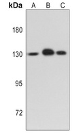 IRE1 Rabbit Polyclonal Antibody