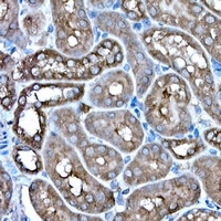 Anti-IRE1 Antibody