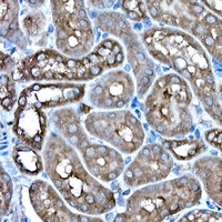 IRE1 antibody