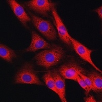 Anti-IRE1 Antibody