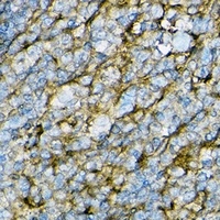 Anti-CD54 Antibody