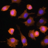 Anti-CD54 Antibody