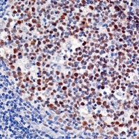 Anti-DNMT1 Antibody