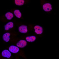 Anti-DNMT1 Antibody