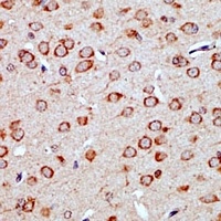 Anti-YAP1 Antibody