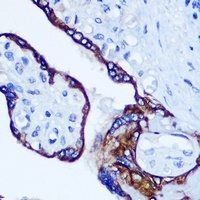 Anti-RhoA Antibody