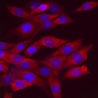 Anti-RhoA Antibody