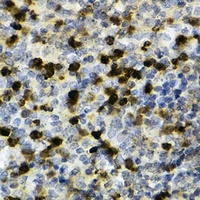 Anti-CD11b Antibody