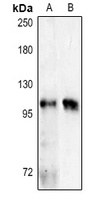 NOD2 Rabbit Polyclonal Antibody