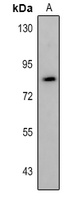 FOXO1 (Acetyl-K245) Rabbit Polyclonal Antibody