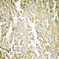 Anti-MATK Antibody