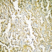 MATK antibody