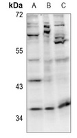 Cyclin D1 Rabbit Polyclonal Antibody