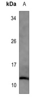 Histone H4 (Acetyl-K91) Rabbit Polyclonal Antibody