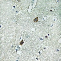 Anti-Connexin 45 Antibody