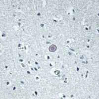 Anti-GPR92 Antibody