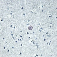 GPR92 antibody