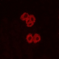 Anti-GPR92 Antibody