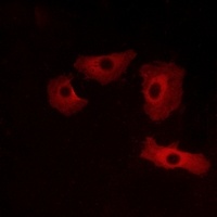 Anti-GPR152 Antibody