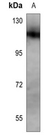 NOTCH1 Antibody