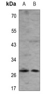 Factor XII LC Antibody