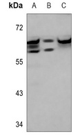 IGF2BP2 Rabbit Polyclonal Antibody