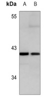 ATP6V0D1 Antibody