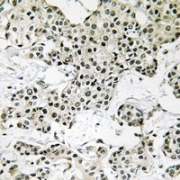Anti-THOC5 Antibody