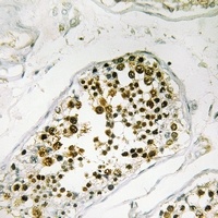 Anti-NEK4 Antibody