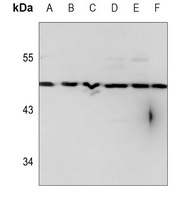 RFPL1 Rabbit Polyclonal Antibody