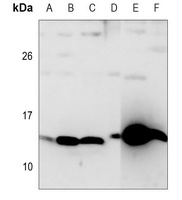 SAA Rabbit Polyclonal Antibody