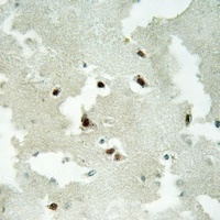 Anti-NCOA5 Antibody