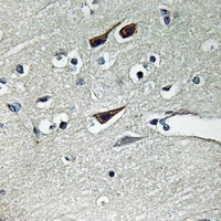 Anti-NOX5 Antibody