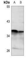 LYS5 Antibody